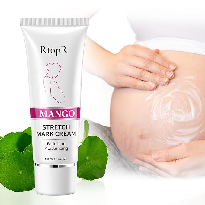 RtopR Mango Stretch Mark Cream for Pregnancy, Stretch Mark Repair Cream, Fade Line, Moisturizing and Non-Greasy, Safe to Use When Pregnant-VivaGrace Women