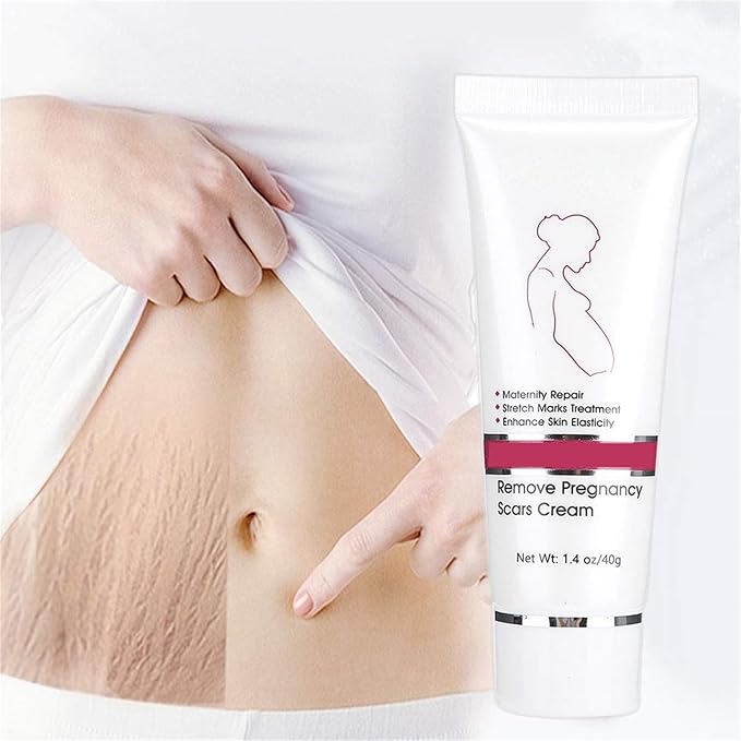 RtopR Stretch Marks and Scar Cream,Crema para Estrias De Embarazo,Stretch Marks Postpartum Repairing Cream Wrinkles Diluting Removal Cream Crema De Cacao para Cicatrices-VivaGrace Women