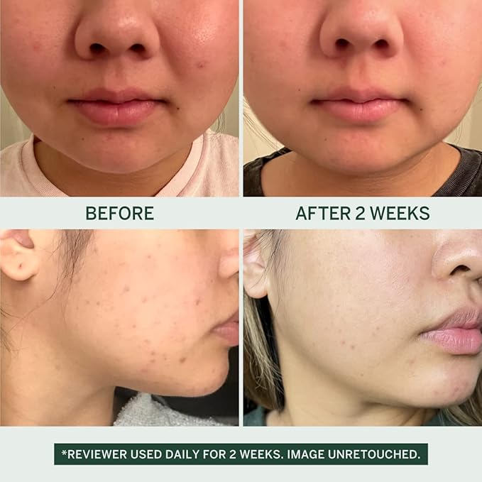 Urban Calm Collection Gift Set - Hydrating, Smoothing, Exfoliating, and Soothing Skincare Set for All Skin Types - Includes Fermented Skincare Products: Cleanser, Essence, Serum, and Cream-VivaGrace Women