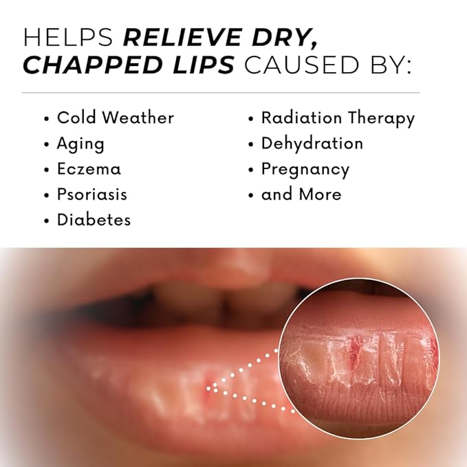 Natural Lip Balm For Very Dry Lips | Pack of 4 | Moisturizing Ghee, Shea Butter, Beeswax, Coconut Oil, & Jojoba Oil | Hydrating Lip Care For Chapped Lips, After Sun Care | Bioserene-VivaGrace Women
