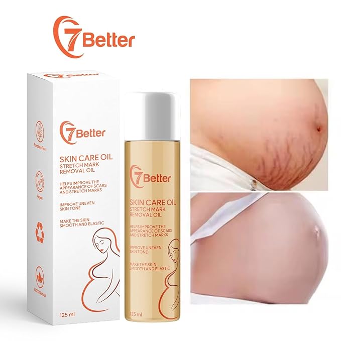 Stretch Mark Pregnancy Oil, Natural Oil Skincare Body Oil Serum for Scars and Stretch Marks, Face with Vitamin E & A for Sensitive Dry Skin and Body Moisturizer-VivaGrace Women
