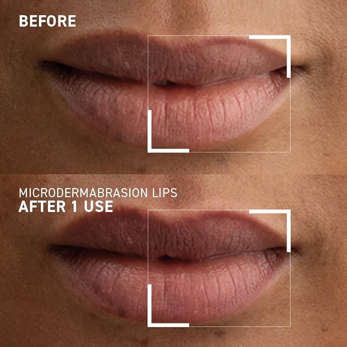 Dr. Brandt Microdermabrasion Smoothing Lip Scrub Gommage Lissant Levres 10 g / 0.35 oz-VivaGrace Women