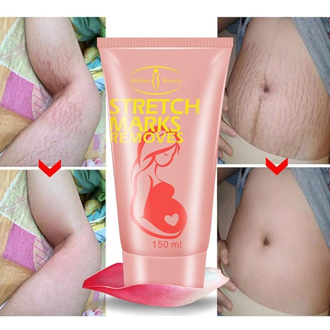 AICHUN BEAUTY Pregnancy Cream Streach Mark Remover Scars Repair Cellulites Lotion Cream 150ml-VivaGrace Women