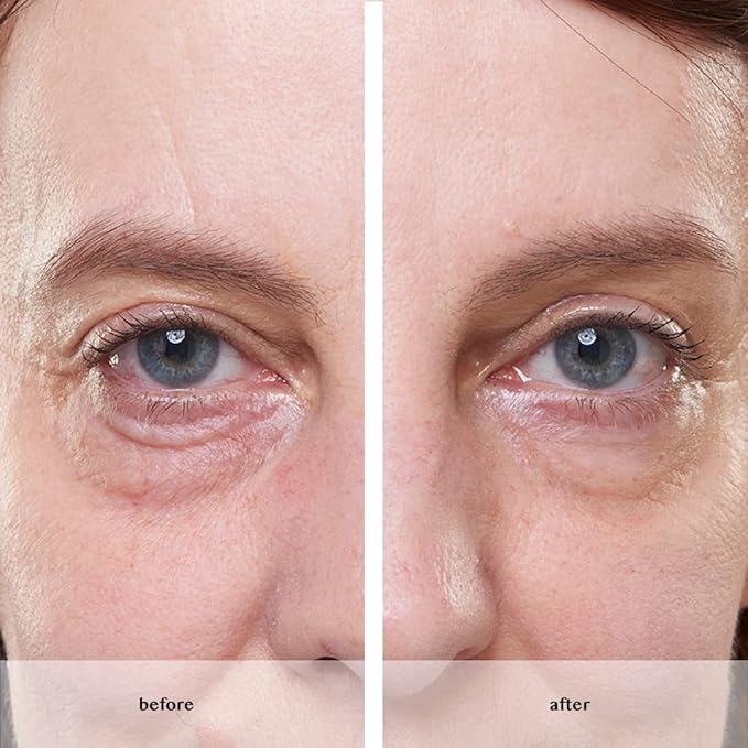 Avon ANEW Platinum Instant Eye Smoother for under eye bags/puffiness/wrinkles - Used Open seal-VivaGrace Women