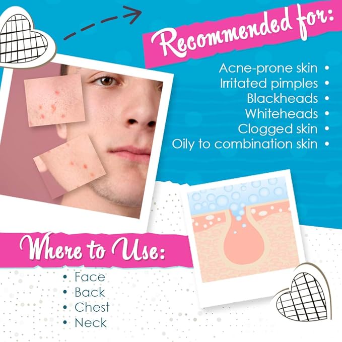 Bye Bye Blemish Acne Drying Lotion, Reduce Pimples Overnight 1oz, 1-Pack-VivaGrace Women