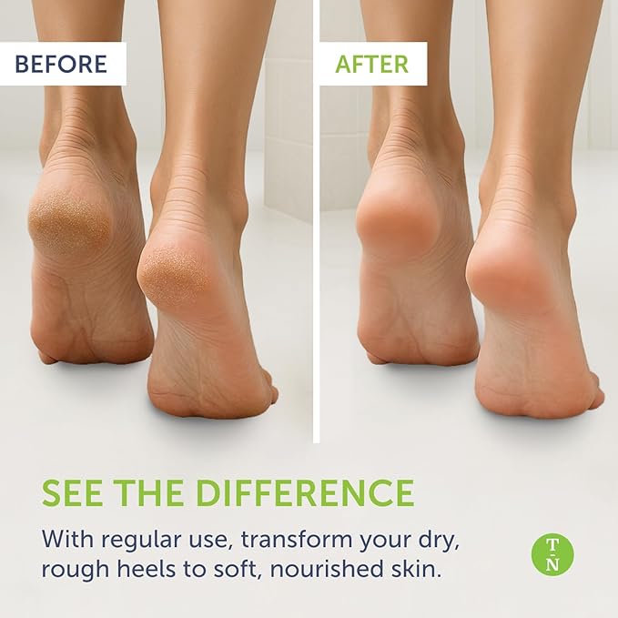 Truremedy Naturals Remedy Balm with Tea Tree Oil, 2 oz - Soothing Moisturizer for Rough Areas - Nourishing Foot and Body Balm with Tea Tree, Lavender, and Eucalyptus-VivaGrace Women