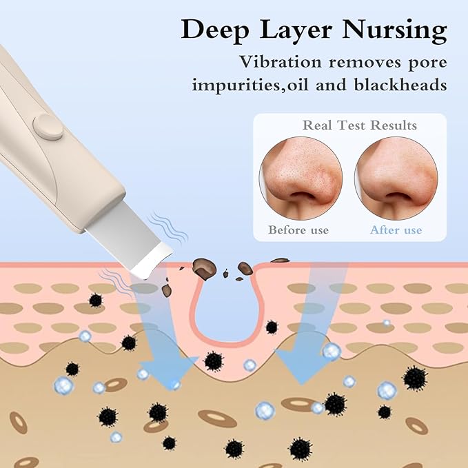 Skin Scrubber Face Spatula Skin Spatula Pore Cleaner Blackhead Remover Tools for Facial Deep Cleansing Skin Care Tool for Men and Women (Beige)-VivaGrace Women