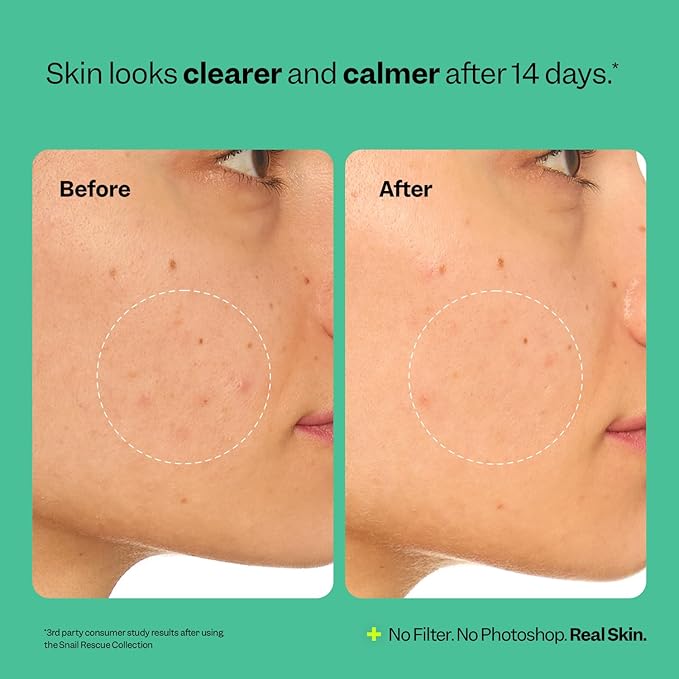 Peach Slices | Snail Rescue Intensive Treatment Wash-Off Face Mask | 95% Snail Mucin | For Dark Spots & Blemishes | Refreshing & Calming Mask | Clear, Radiant, & Hydrated Skin | Skin Care | 3.38 oz-VivaGrace Women