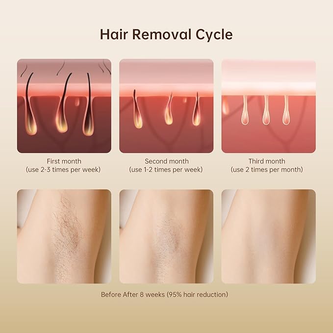 Laser Hair Removal IPL Laser Hair Removal for Women and Men Permanent, 999999 Flashes, At-Home Hair Removal Device for Facial Legs Arms Whole Body Use (White Gold)-VivaGrace Women