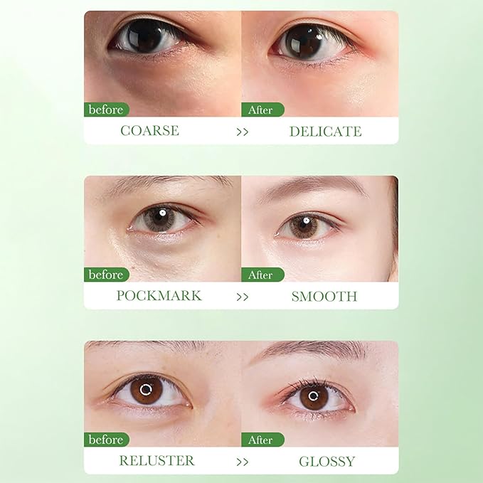 BIOAQUA Centella Asiatica Nourish Repair Eye Cream Soothing Oil Control Anti-Acne 20g / 0.7oz-VivaGrace Women