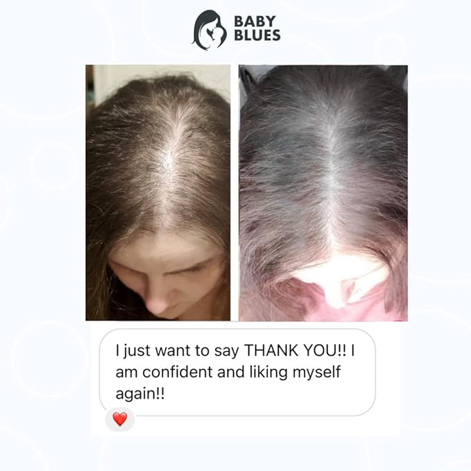 Baby Blues Postpartum Hair Loss Vitamins - Full Hair Cycle Pack - with Biotin, Collagen, & Folate-VivaGrace Women