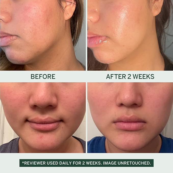 Urban Calm Collection - Fermented Skincare Bundle - for All Skin Types - Anti-Aging Skincare Set for Hydrating, Firming, Exfoliating, Soothing - With Cleanser, Essence, Serum, and Cream-VivaGrace Women