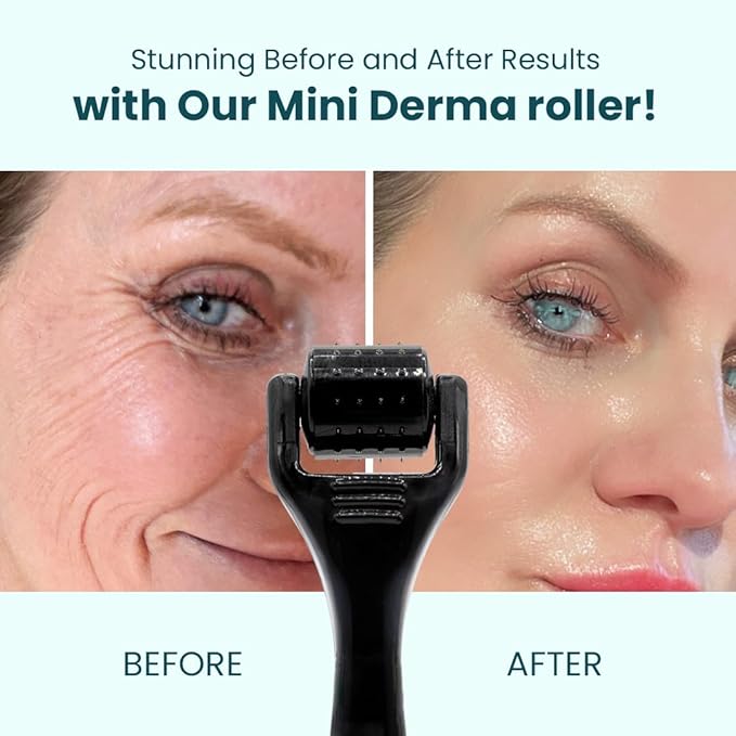 Gin Amber Beauty Mini Derma roller (0.25mm) - 48 Real Individual Needles, Microdermabrasion Device for Skin Care, Serum Absorption with Microneedling, Tool, Hygienic Case (Black Mini 0.25mm)-VivaGrace Women
