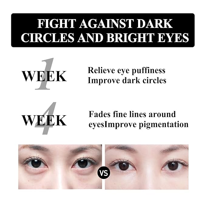 Retinol Snake Venom Peptide Eye Cream, Firming Eye Cream, Anti Ageing Eye Cream, Under Eye Cream For Puffiness and Bags Reduces Fine Lines-VivaGrace Women
