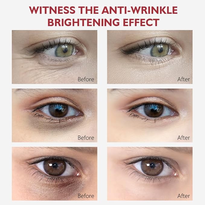 Retinol Eye Cream, Anti-Aging with Vitamin C & Ceramide for Dark Circles, Wrinkles & Fine Lines, Crow’s Feet, 0.7 fl.oz-VivaGrace Women