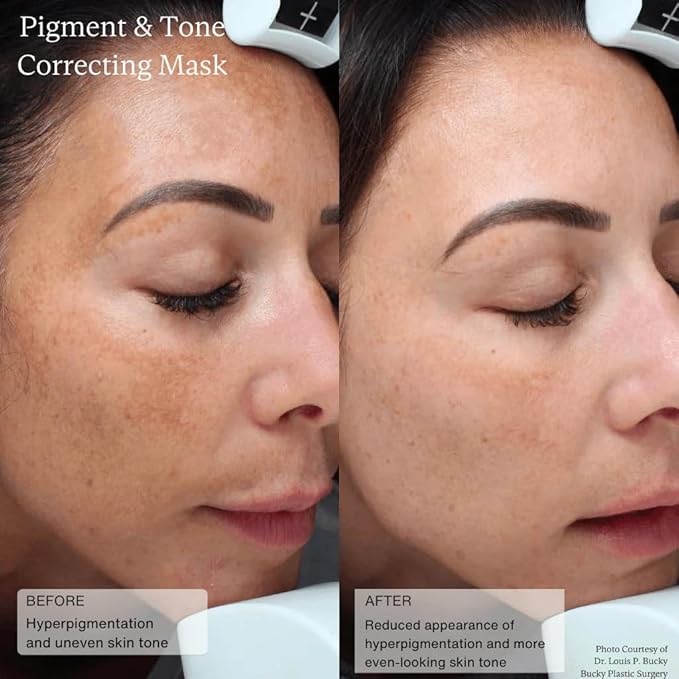 Senté Cysteamine HSA Pigment and Tone Corrector- Hyperpigmentation Treatment For Reducing The Appearance of Dark Spots And Improving Skin Tone - 1.7 Fl Oz-VivaGrace Women