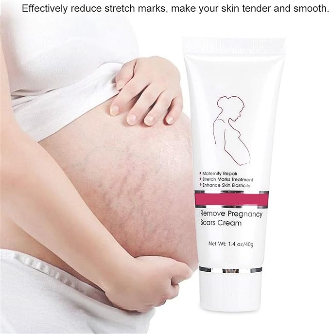 RtopR Stretch Marks and Scar Cream,Crema para Estrias De Embarazo,Stretch Marks Postpartum Repairing Cream Wrinkles Diluting Removal Cream Crema De Cacao para Cicatrices-VivaGrace Women