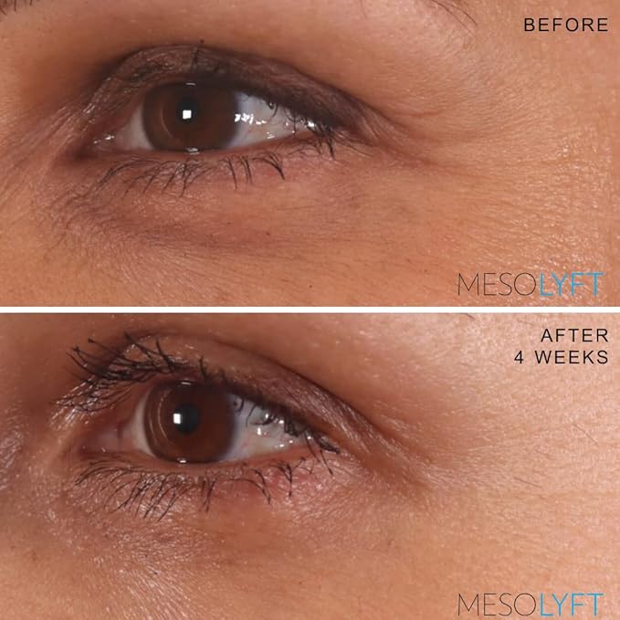 Neck & Eyes Combo Skincare Tool under Eye Serum With Neck Line Remover Neck and Décolletage Beuty Tool & Under Eye Wrinkle Filler Exfoliates the Skin, Visibly Firm & Smooth Necklines-VivaGrace Women