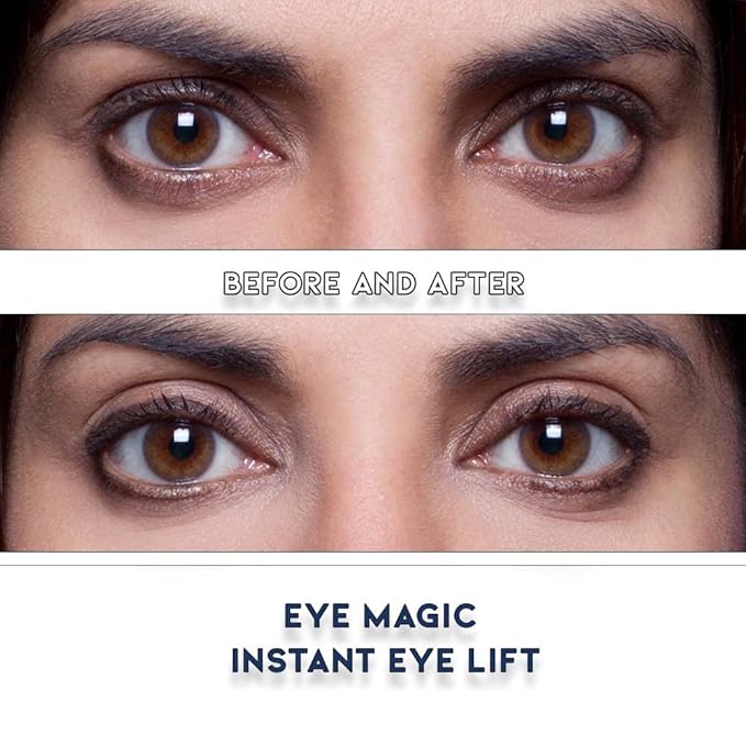 Eye Magic Premium Eye Lift (S/M Kit + Gel) Made in America Instantly Lifts and Defines Droopy, Sagging or Hooded Eyes Safe For Daily Use-VivaGrace Women