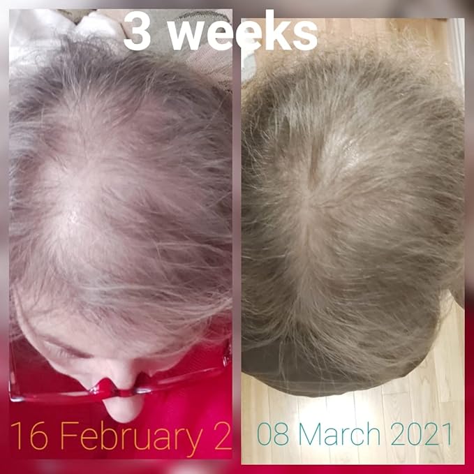 CRISAN 16oz Extreme Hair Growth and Strengthening Oil for Men and Women (16 fl oz)-VivaGrace Women