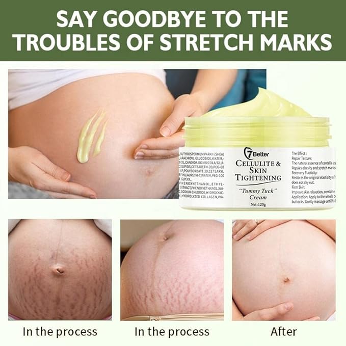 Stretch Marks and Scars Removal Cream for Pregnancy - Scars Repair, Abdominal Firming, and Gentle Stretch Marks Eradication Skincare Body-VivaGrace Women