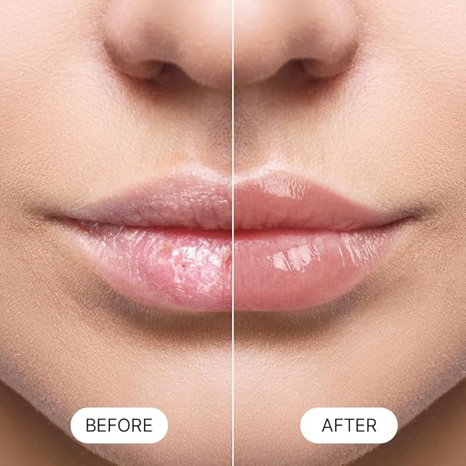 Essential Lip Balm Blue Collagen (HONEY VITA C)-VivaGrace Women