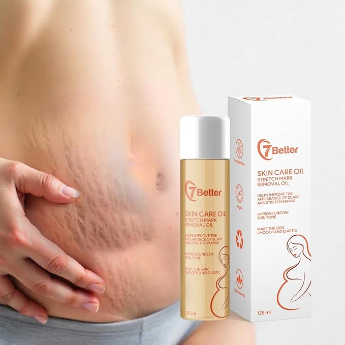 Stretch Mark Pregnancy Oil, Natural Oil Skincare Body Oil Serum for Scars and Stretch Marks, Face with Vitamin E & A for Sensitive Dry Skin and Body Moisturizer-VivaGrace Women