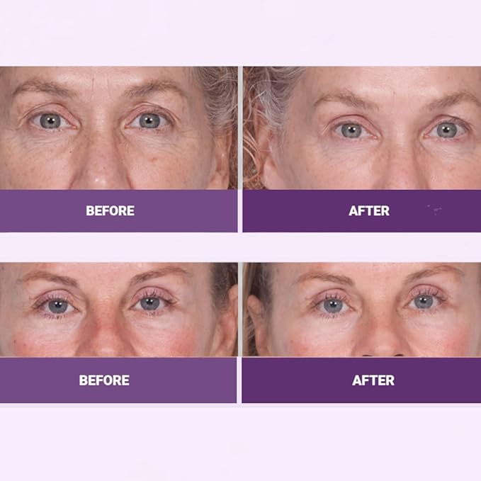 Serious Skincare INSTA-TOX Facial Firming Wrinkle Smoothing Serum and Reverse Lift Firming Eye Cream Set - Filler for Fine Lines, Deep Wrinkles and Pores - Temporary Eye Tightener-VivaGrace Women