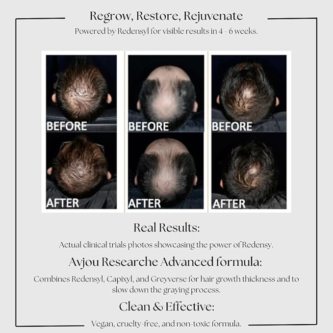 Avjou Researche™ Scalp Serum – Thicker, Fuller-Looking Hair + Targets Visible Signs of Premature Greying – 3 Patented Ingredients – Backed by Cosmetic Science – Oil-Free, All Hair Types, 1.7 oz-VivaGrace Women