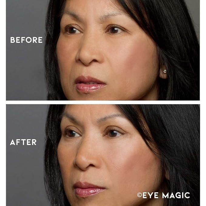 Eye Magic Premium Eye Lift (S/M Refill) Made in America. Instantly Lifts and Defines Droopy, Sagging or Hooded Eyes Safe for Daily Use-VivaGrace Women