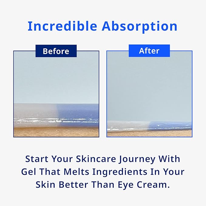 Moist Moment Under Eye Patches | Hydrating Eye Treatment Gel Masks With Hyaluronic acid & Squalane | Under Eye Masks For Dark Circles and Puffiness, Under Eye Bags, Wrinkle Care, Men and Women-VivaGrace Women