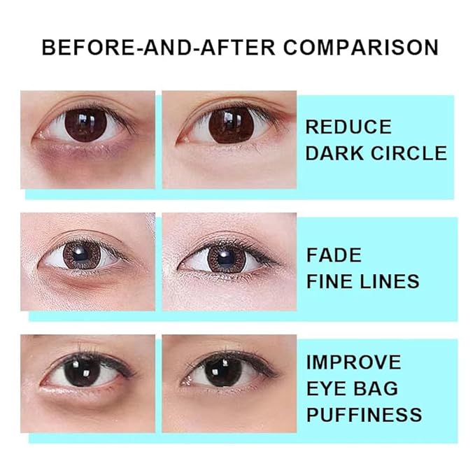 Snail Peptide Eye Cream, Snail Mucin Eye Cream Contains Niacinamide, Hyaluronic Acid To Reduce Wrinkles, Dark Circles, Puffiness and Fine Lines 17 ML-VivaGrace Women