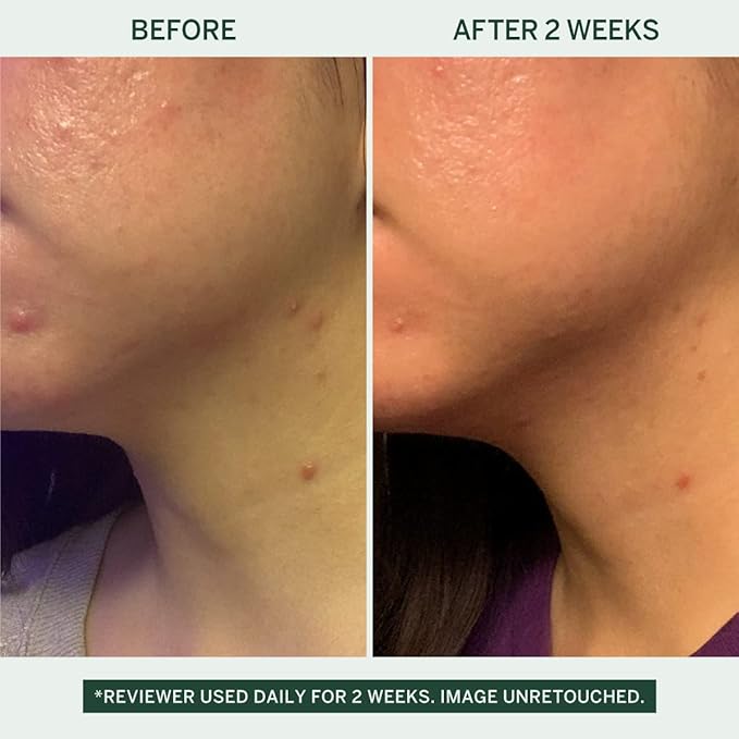 Urban Calm Collection Gift Set - Hydrating, Smoothing, Exfoliating, and Soothing Skincare Set for All Skin Types - Includes Fermented Skincare Products: Cleanser, Essence, Serum, and Cream-VivaGrace Women