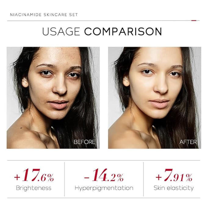 Niacinamide Skincare Set: 4pcs Beauty Kit with Cleanser, Toner, Serum, & Facial Cream - Hydrates & Evens Skin Tone - TSA-Friendly Travel Sizes, Perfect Gift for Women, Moms, & Teens-VivaGrace Women