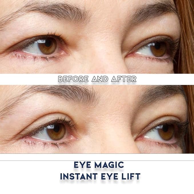 Eye Magic Premium Eye Lift (S/M Kit + Gel) Made in America Instantly Lifts and Defines Droopy, Sagging or Hooded Eyes Safe For Daily Use-VivaGrace Women