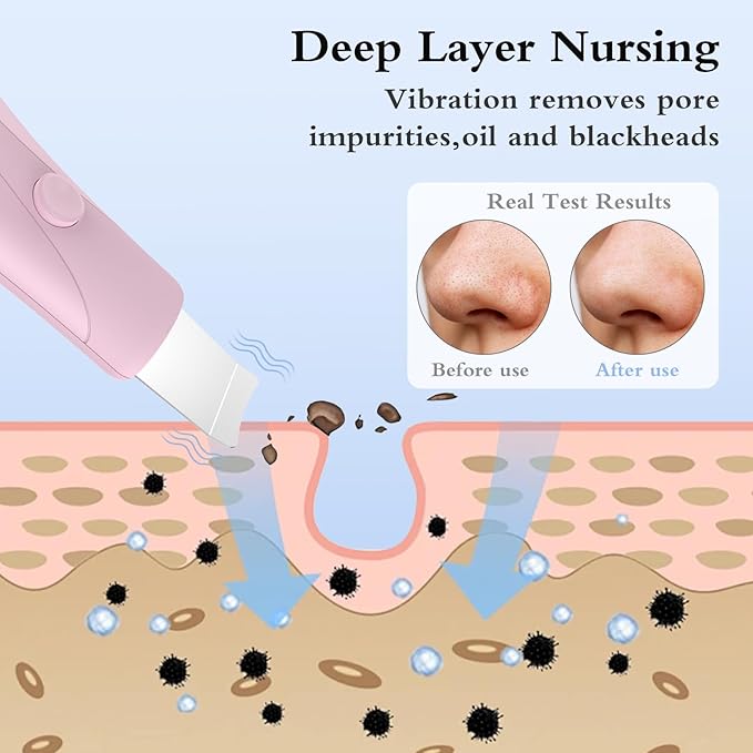 Skin Scrubber Face Spatula Skin Spatula Pore Cleaner Blackhead Remover Tools for Facial Deep Cleansing Skin Care Tool for Men and Women (Pink)-VivaGrace Women