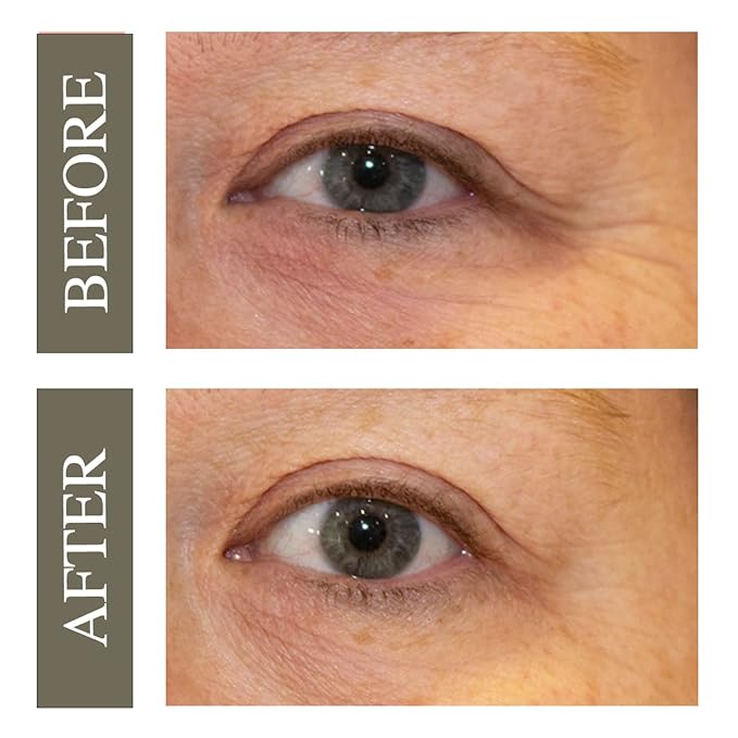 Hey Honey Open Your Eyes Lifting Eye Serum | Under Eye Cream for Dark Circles & Puffiness | Around The Eyes Hydration | Suitable For Sensitive Aging Skin | Delivers A Bright Rested look | 0.5 oz.-VivaGrace Women