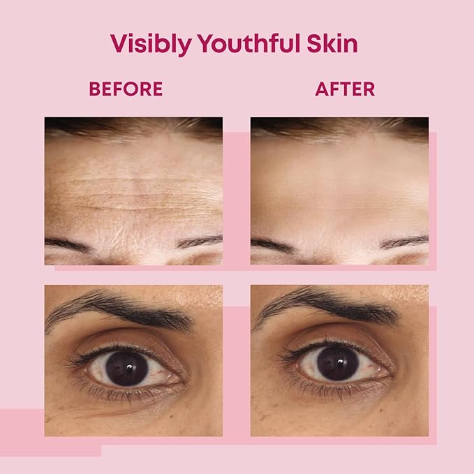 Bayside Forehead & Under Eye Wrinkle Patches Set | Hyaluronic Acid, Collagen & Vitamin E | Overnight Smoothing Treatment for Fine Lines & Wrinkles | Non-Invasive, Skin-Friendly Hydrating Care-VivaGrace Women