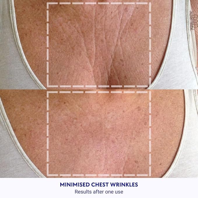 Wrinkles Schminkles Chest Wrinkle Patch & Cleanser Starter Pack - Set of Reusable Chest Silicone Wrinkle Patch + Patch Cleanser (2 oz) Maximise Uses - Smooth & Prevent Chest & Décolletage Wrinkles-VivaGrace Women