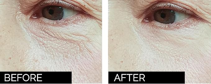 Anti-age under eye masks - With Hyaluronic Acid, Collagen & Vitamin C. Natural gel eye masks, under eye gel patches for dark circles & puffy eyes. Anti wrinkle skincare, hydrating & soothing. 20 pairs-VivaGrace Women