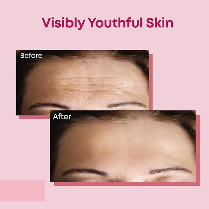 Forehead Wrinkle Patches | Anti-Wrinkle Facial Patches for Fine Lines | Overnight Wrinkle Filler & Deep Line Treatment | Disposable Face Tape for a Youthful, Firmer, and Smoother Appearance | 20 Count-VivaGrace Women