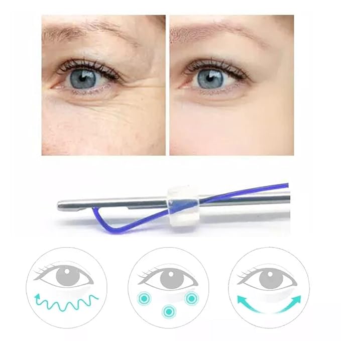 Pdo Threads Eye Lift for Eyes, Mono Screw Type, B-Type, 30G25MM, 20pcs-VivaGrace Women