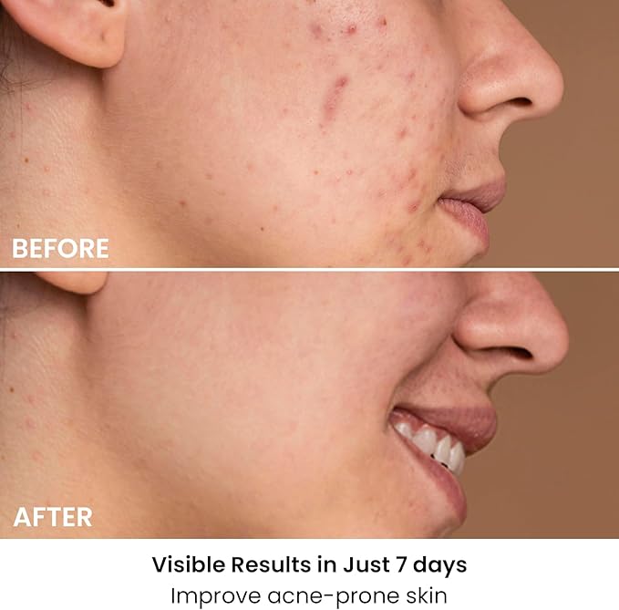 AMIRO Spectra 5-in-1 Light Therapy Face Mask, Contour With Blue, Red, Green, Yellow, and Infrared Light, 3 Modes for Oily, Acne-Prone, and Sagging Skin, Skincare for Face, Silver-VivaGrace Women