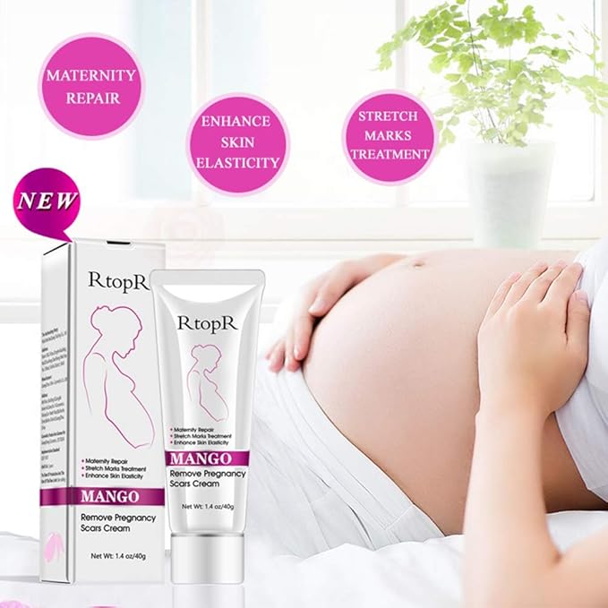 Mango Stretch Marks and Scar Cream, Stretch Marks and Scar Removal Cream for Pregnancy, Stretch Marks Scar Belly Creams for Wrinkles, Obesity Fat Stretch Mark Moisturizing, Remove Marks (40g)-VivaGrace Women