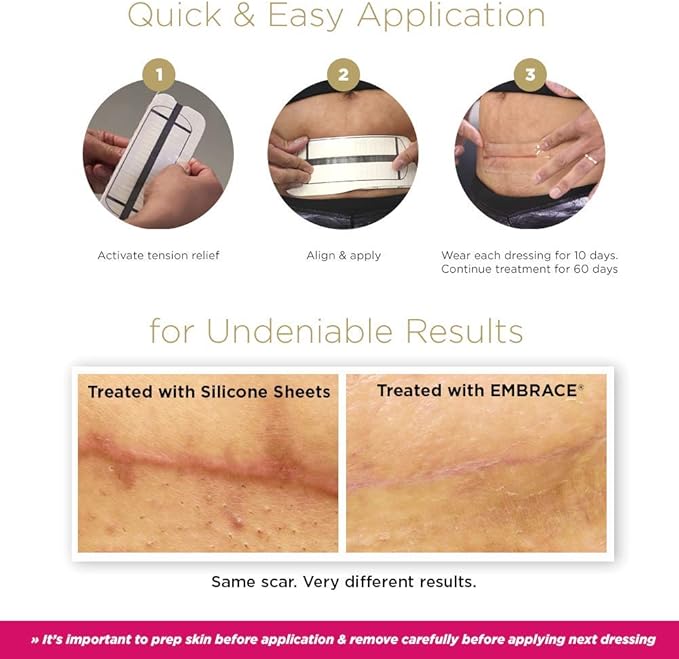 Embrace Active Scar Defense for New Scars, FDA-Cleared Silicone Scar Sheets, 2.4 Inch, Medium, 60 Day Supply (Recommended Treatment)-VivaGrace Women
