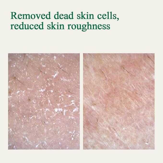 [PKY] Pyunkang Yul Ultimate Calming Solution Toner with Honeysuckle Flower, Ceramides, Hyaluronic Acid, Centella Asiatica, for Moisturized, Nourishing, Sensitive, Tired Facial Skin 3.71fl.oz.-VivaGrace Women