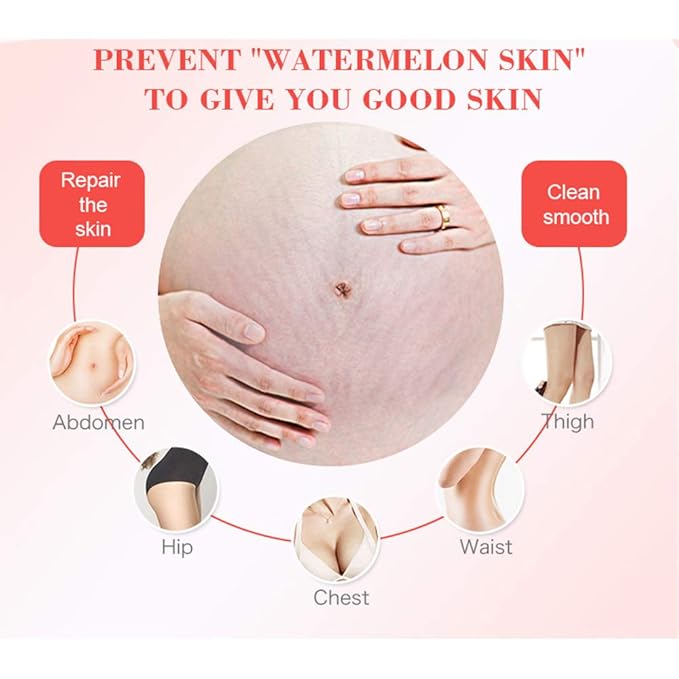 AICHUN BEAUTY Pregnancy Cream Streach Mark Remover Scars Repair Cellulites Lotion Cream 150ml-VivaGrace Women