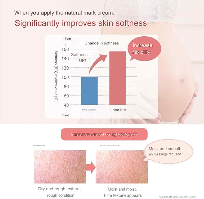 Mama & Kids Natural Cream/Stretch Mark Cream 150g japanese-VivaGrace Women