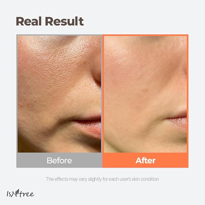 ISNTREE Green Tea Fresh Toner 200ml, 6.76 fl.oz | Korean Skincare | Toner for Oily Skin | Sebum Control | Hydrating and Refreshing-VivaGrace Women