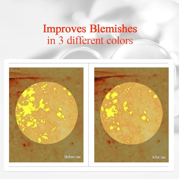 Pyunkang Yul PKY Radiance Vita Toner for Flawless and Radiant Skin, Blemish Care Toner with Vitamin C & Niacinamide, Zero Irritation, Korean Skincare (5.07 Fl. Oz, 150ml)-VivaGrace Women